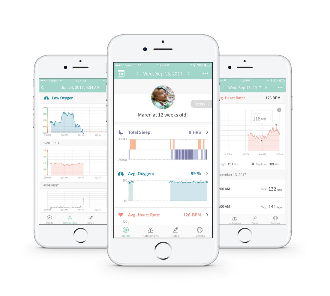 Owlet Reinvents the Baby Monitor With New Smart Sock and Unparalleled Connected Care Platform for Parents