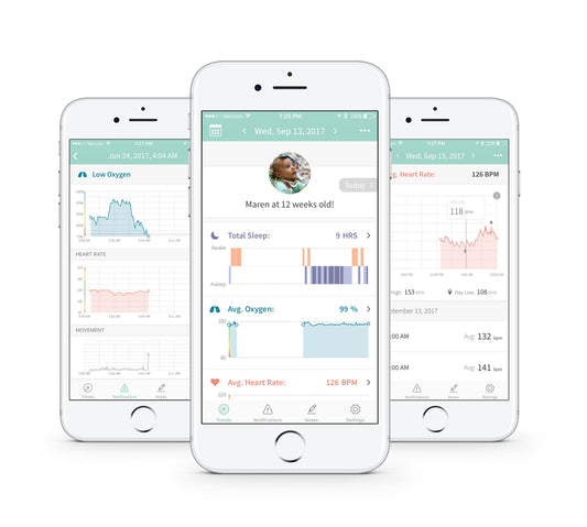 Owlet Reinvents the Baby Monitor With New Smart Sock and Unparalleled Connected Care Platform for Parents